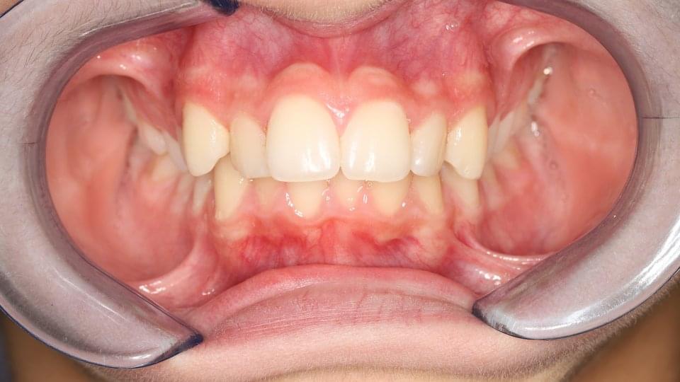 Начално състояние