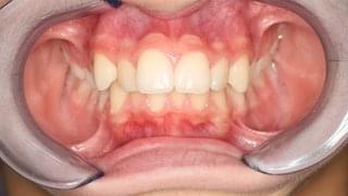 Начално състояние