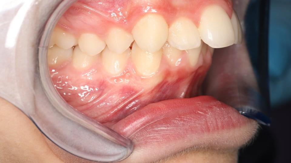 Множество отклонения