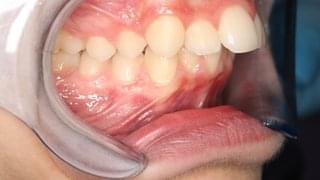 Множество отклонения