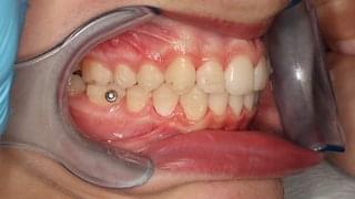 Видима промяна