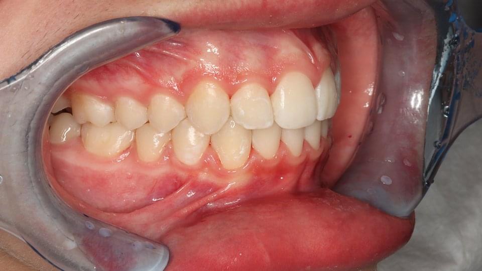 Успешно лечение