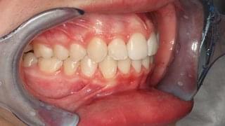 Успешно лечение