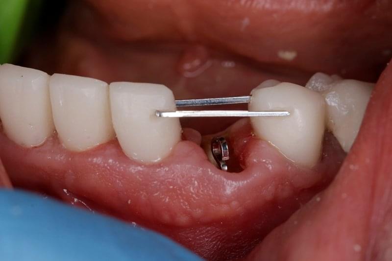 Състояние преди стоматологичната намеса