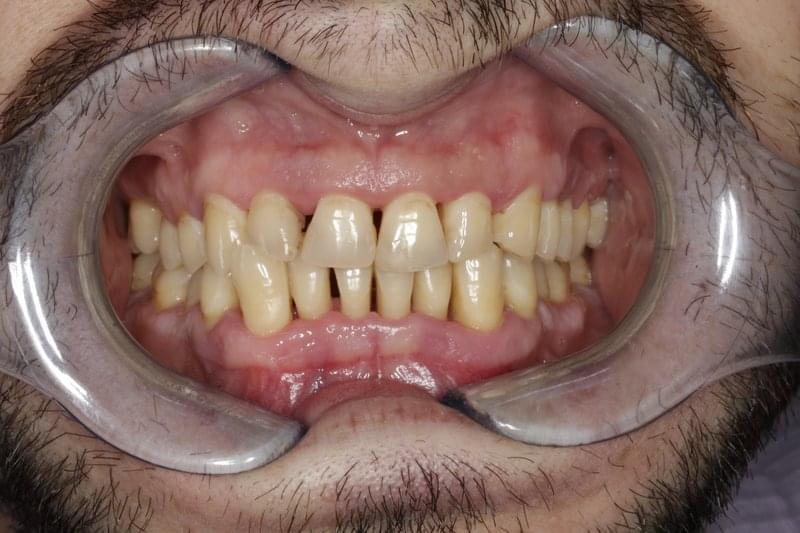 Клиника за лечение на пародонтоза стоматология в томске денталия